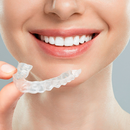 Braces/Invisalign Aligners