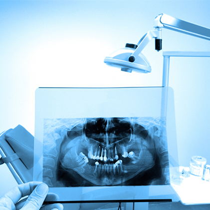 IOPA (RVG) & Full Mouth X-ray OPG